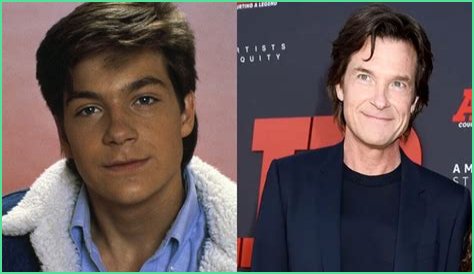 Jason Bateman Plastic Surgery Before and After